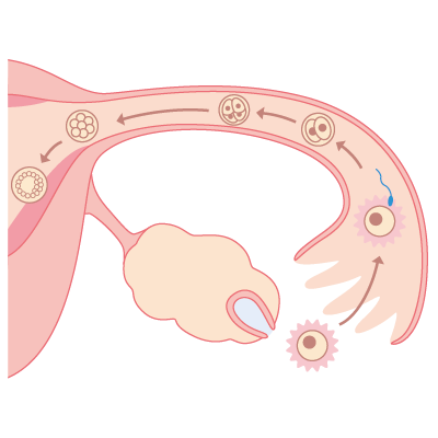 圖 2,精子與卵細胞在輸卵管相遇結合，並在子宮內著床